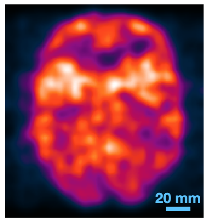 20mm image produced by this new imaging technique