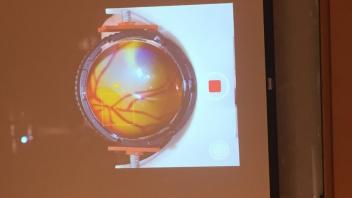 uc davis biomedical engineering opthalmology education