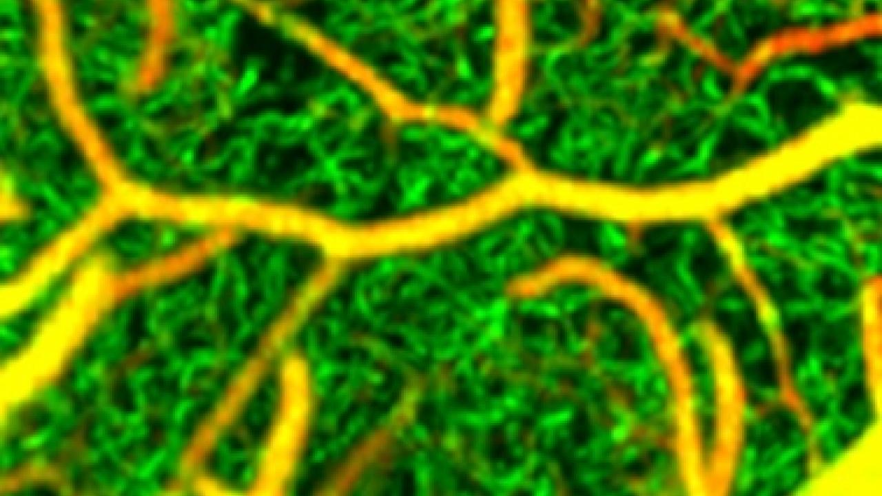 Cortex Scan