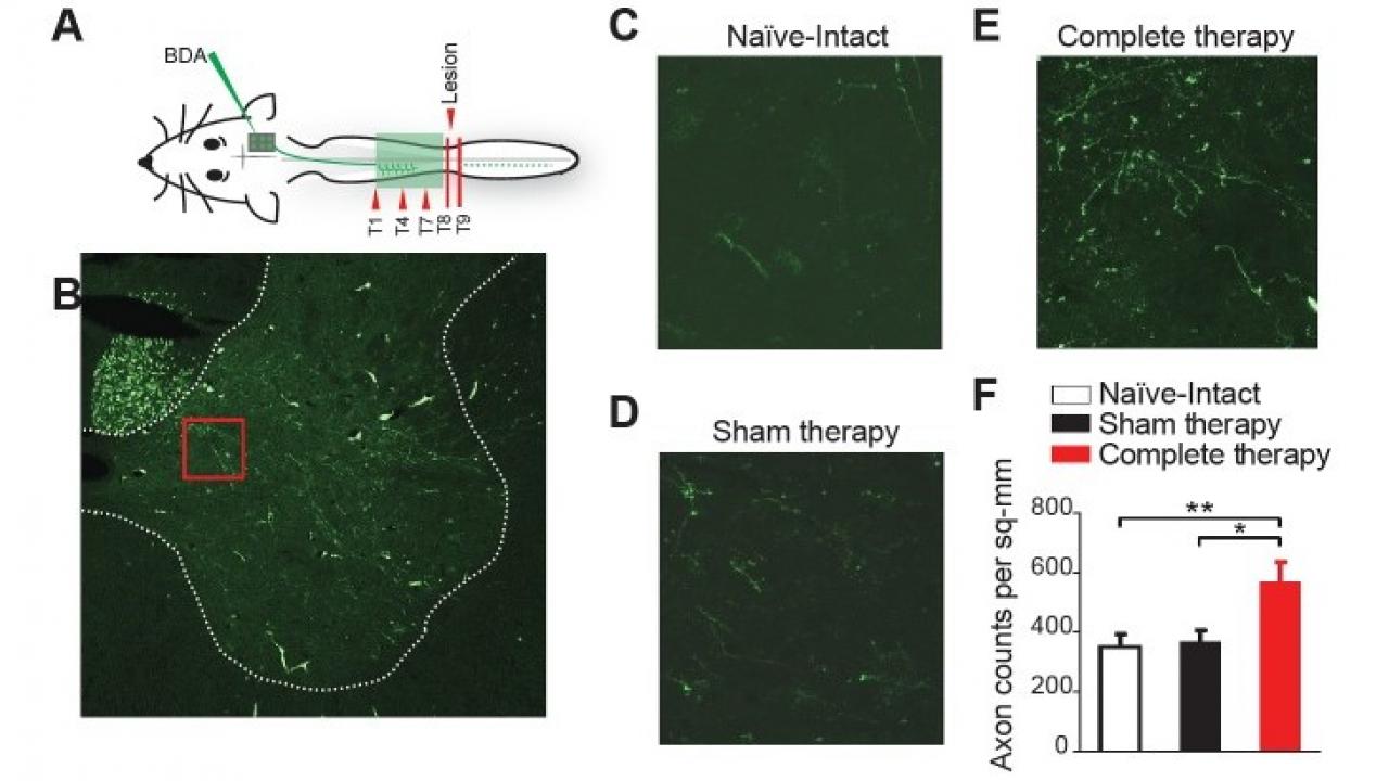 Corticospinal sprouting into the thoracic spinal cord. (A) Diagram illustrating anterograde tracing experiments. (B) Histology of a sample coronal slice of the thoracic spinal hemi-cord taken from above the level of the spinal lesion and a magnified view of the sprouting into the grey matter in (C) Naïve-Intact (D) Sham therapy and (E) Complete therapy groups. (F) Bar graphs showing the average count of corticospinal axons sprouting per mm2 of gray matter of the spinal hemi-cord for the different groups. *p<0.05, **p<0.01. Error bars indicate 95% confidence intervals. (Credit: Karen Moxon) uc davis biomedical engineering cortical plasticity treatment rats