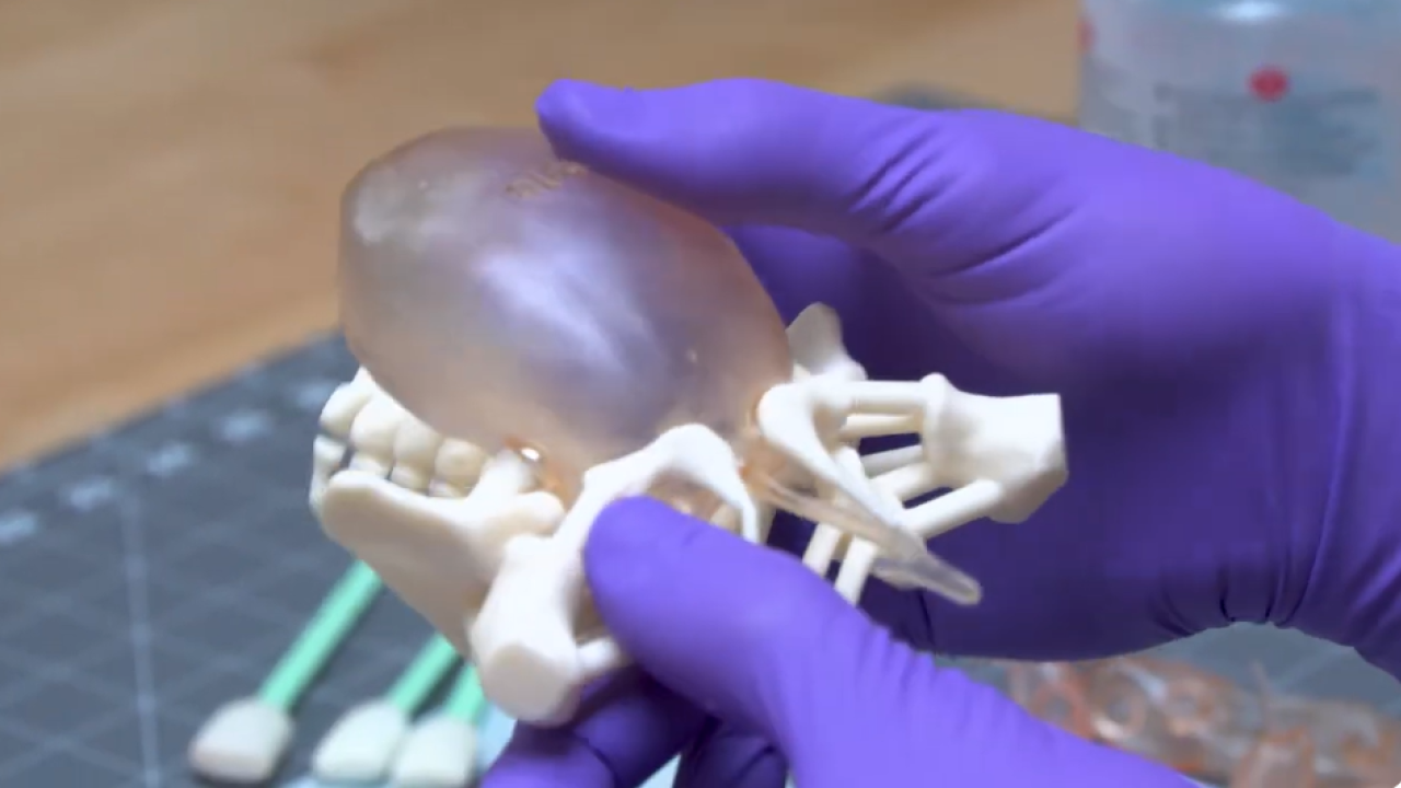 A 3D-printed model of someone with common cloaca