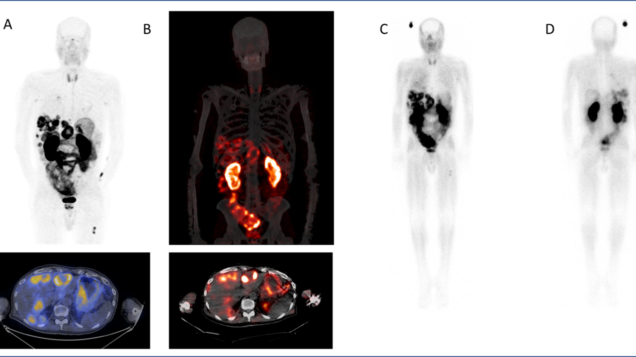 Multiple scans create one image