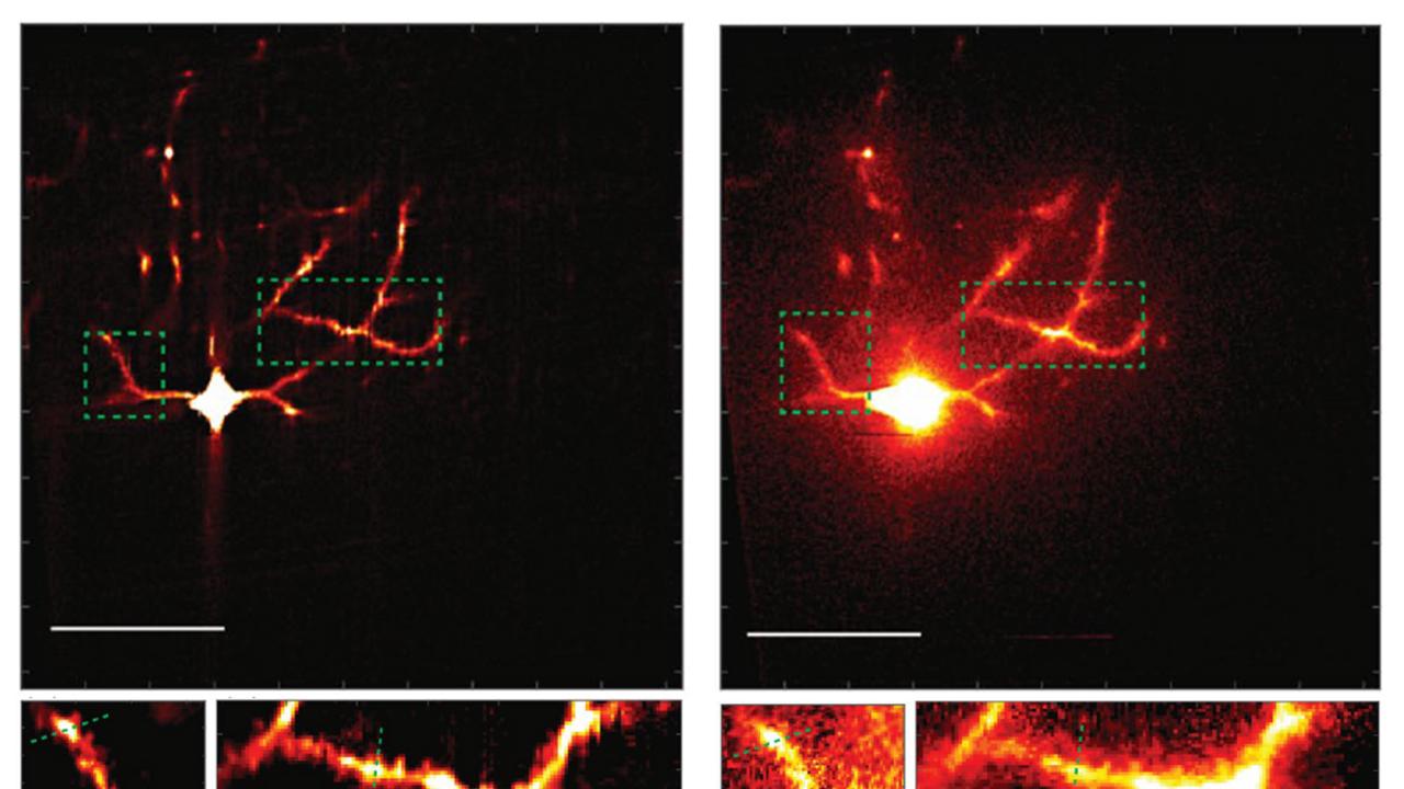 Two types of live brain imaging are compared by how they visualize a neuron