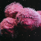 An up-close photo of pink P-cadherin proteins